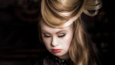 10 Of The Most Successful People With Down Syndrome